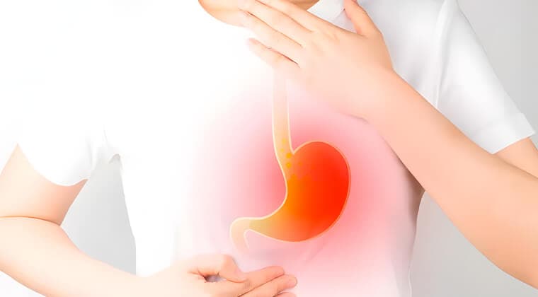 Enfermedad por reflujo gastroesofágico (ERGE) complicada