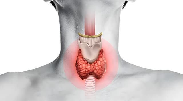 Enfermedad tiroides (Bocio con síntomas compresivos, Cáncer de tiroides)